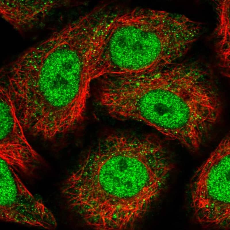 Immunocytochemistry/ Immunofluorescence Nope/IGDCC4 Antibody - BSA Free