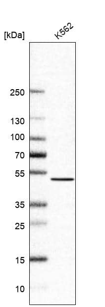 Analysis in human cell line K562.