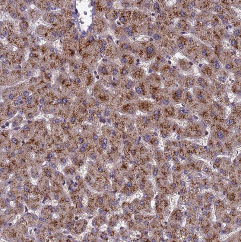 Staining of human Liver shows strong granular cytoplasmic positivity in hepatocytes.