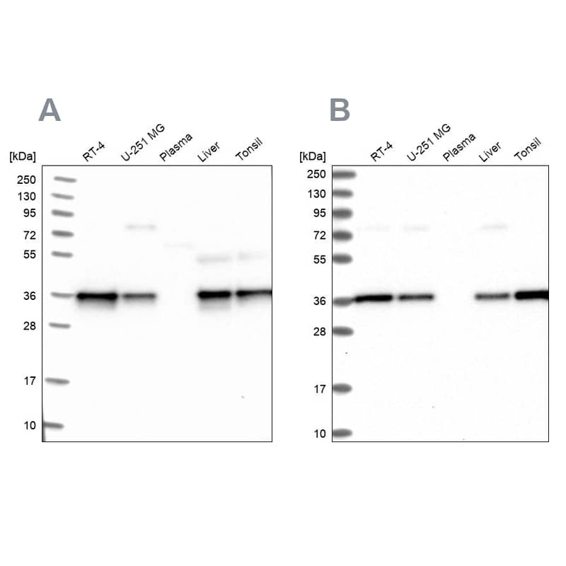 <b>Independent Antibodies Validation. </b>Analysis using antibody NBP1-92205 (A) shows similar pattern to independent antibody NBP1-92204 (B).