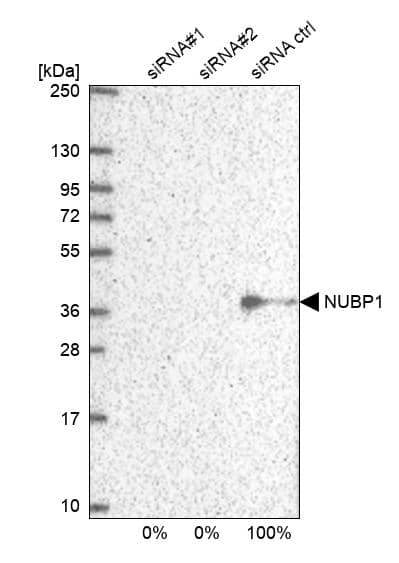 <b>Genetic Strategies Validation. </b>Analysis in U2OS cells transfected with control siRNA, target specific siRNA probe #1 and #2. Remaining relative intensity is presented.