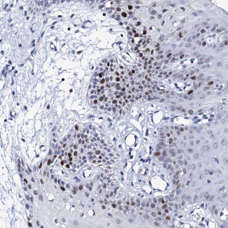 Immunohistochemistry-Paraffin NUDT13 Antibody - BSA Free