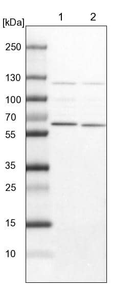 Lane 1: NIH-3T3 cell lysate (Mouse embryonic fibroblast cells)Lane 2: NBT-II cell lysate (Rat Wistar bladder tumour cells)