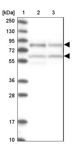 Lane 1: Marker [kDa] 250, 130, 95, 72, 55, 36, 28, 17, 10Lane 2: Human cell line RT-4Lane 3: Human cell line U-251MG sp