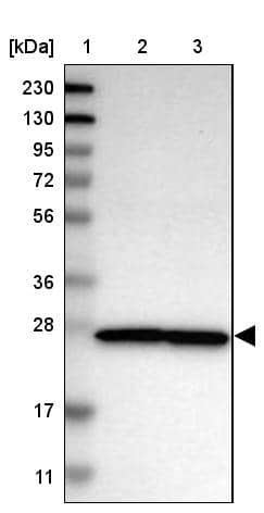 Lane 1: Marker [kDa] 230, 130, 95, 72, 56, 36, 28, 17, 11Lane 2: Human cell line RT-4Lane 3: Human cell line U-251MG sp