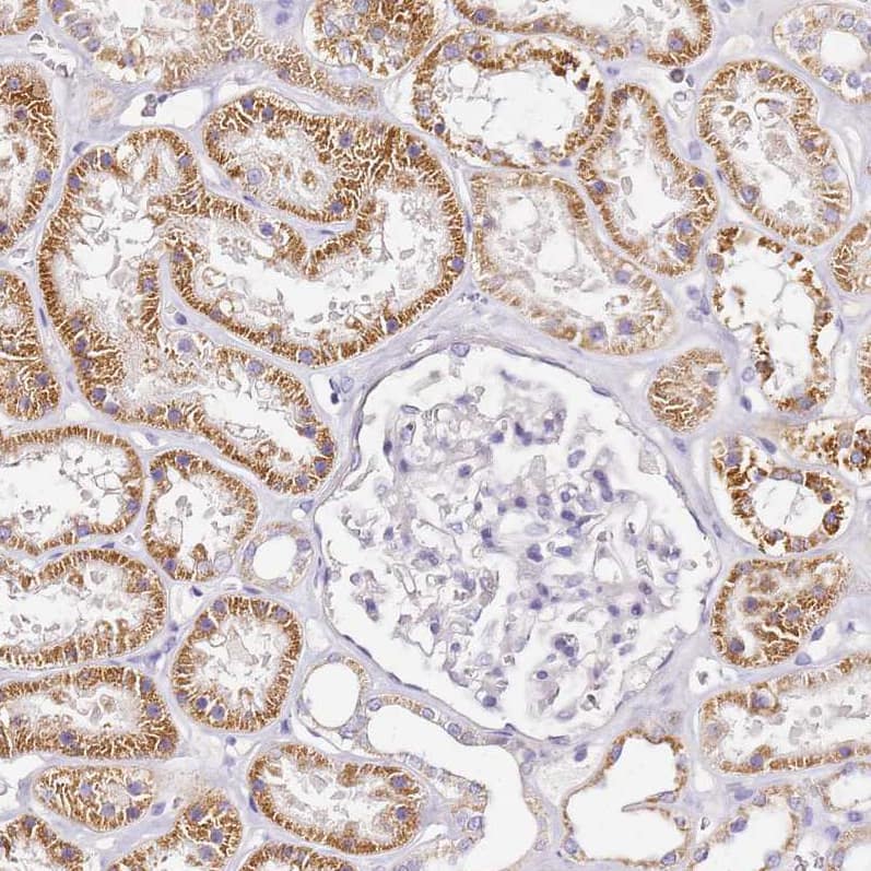 Staining of human kidney shows strong granular cytoplasmic positivity in cells in tubules.