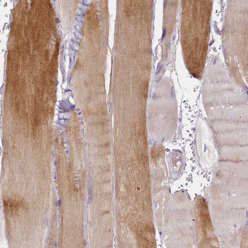 Staining of human skeletal muscle shows strong cytoplasmic positivity in myocytes.