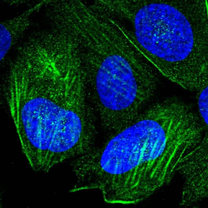 Immunocytochemistry/ Immunofluorescence P2X4 Antibody - BSA Free