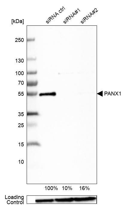 Analysis in U-138MG cells transfected with control siRNA, target specific siRNA probe #1 and #2. Remaining relative intensity is presented. Loading control: Anti-GAPDH.