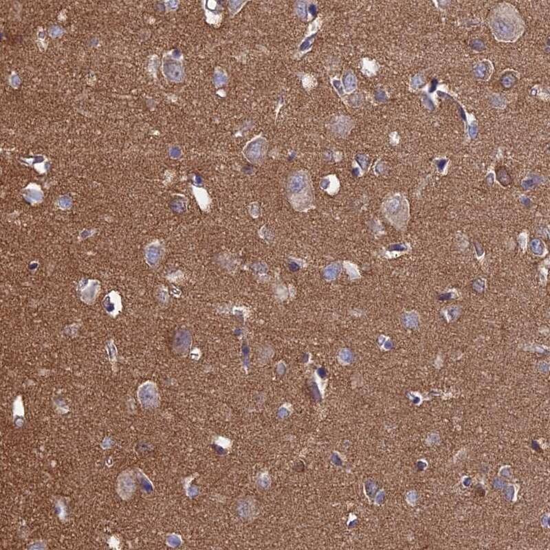 Staining of human cerebral cortex shows distinct positivity in neuropil.