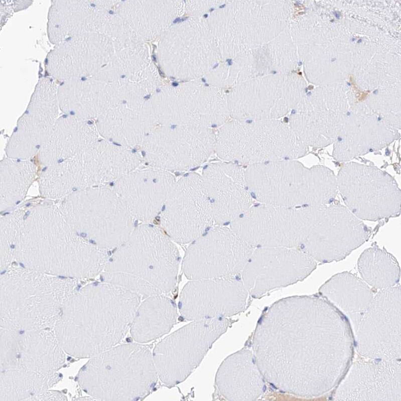 Staining of human skeletal muscle shows no positivity in myocytes as expected.