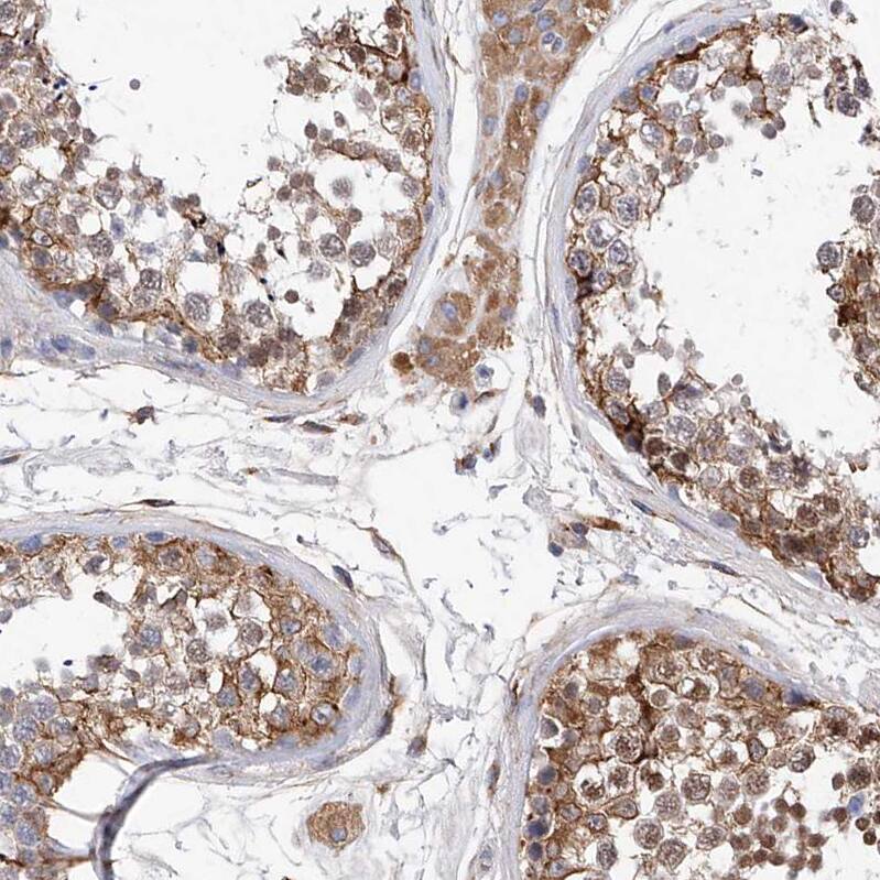 Staining of human testis shows moderate to strong  granular cytoplasmic positivity Leydig cells and in cells in seminiferous ducts.