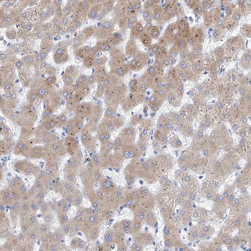 Staining of human liver shows moderate granular cytoplasmic positivity in hepatocytes.