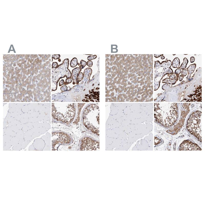 <b>Orthogonal Strategies Validation. </b>Staining of human liver, placenta, skeletal muscle and testis HPA030353 (A) shows similar protein distribution across tissues to independent antibody HPA030355 (B).