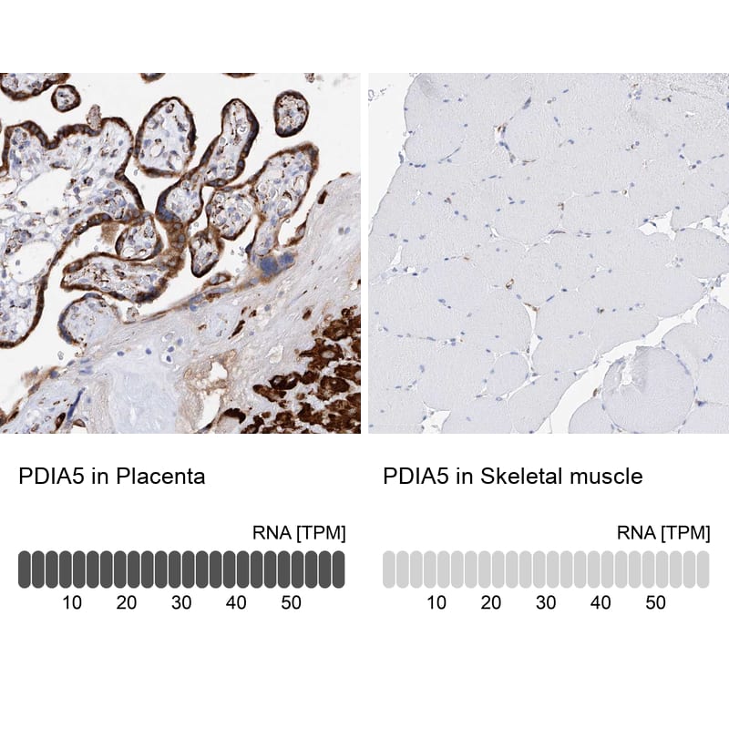Analysis in human placenta and skeletal muscle tissues using NBP1-92252 antibody. Corresponding PDIA5 RNA-seq data are presented for the same tissues.
