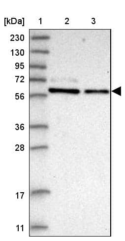 Lane 1: Marker [kDa] 230, 130, 95, 72, 56, 36, 28, 17, 11Lane 2: Human cell line RT-4Lane 3: Human cell line U-251MG sp