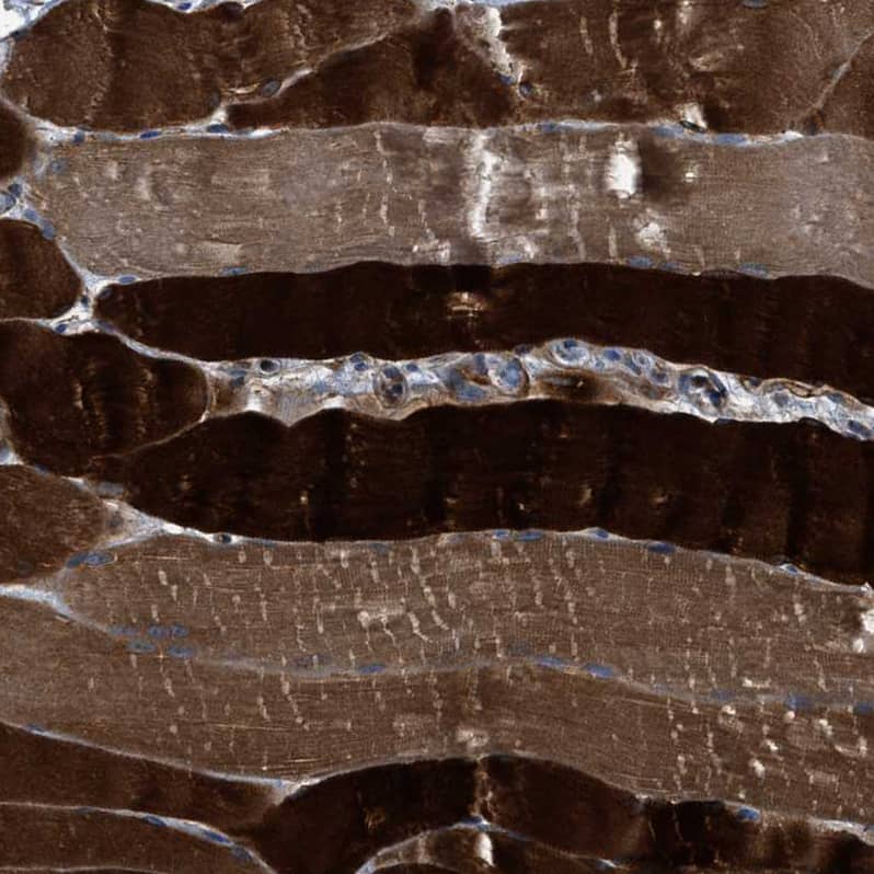 Staining of human skeletal muscle shows strong cytoplasmic positivity in myocytes.