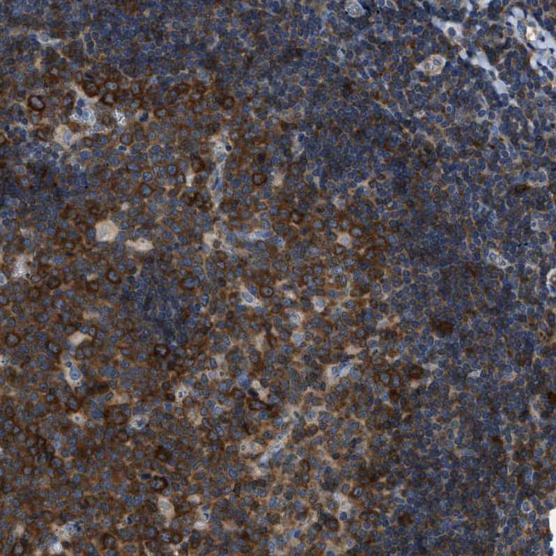 Staining of human tonsil shows strong cytoplasmic positivity in germinal center cells.