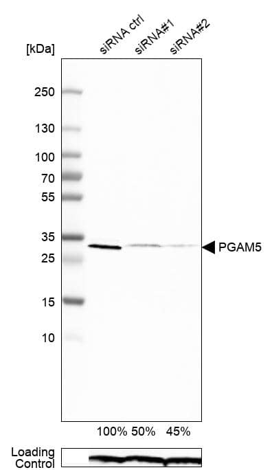 <b>Genetic Strategies Validation. </b>Analysis in RT-4 cells transfected with control siRNA, target specific siRNA probe #1 and #2. Remaining relative intensity is presented. Loading control: Anti-PPIB.