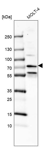 Analysis in human cell line MOLT-4.