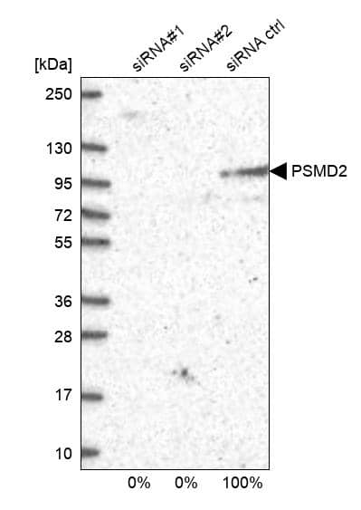 <b>Genetic Strategies Validation. </b>Analysis in U2OS cells transfected with control siRNA, target specific siRNA probe #1 and #2. Remaining relative intensity is presented.