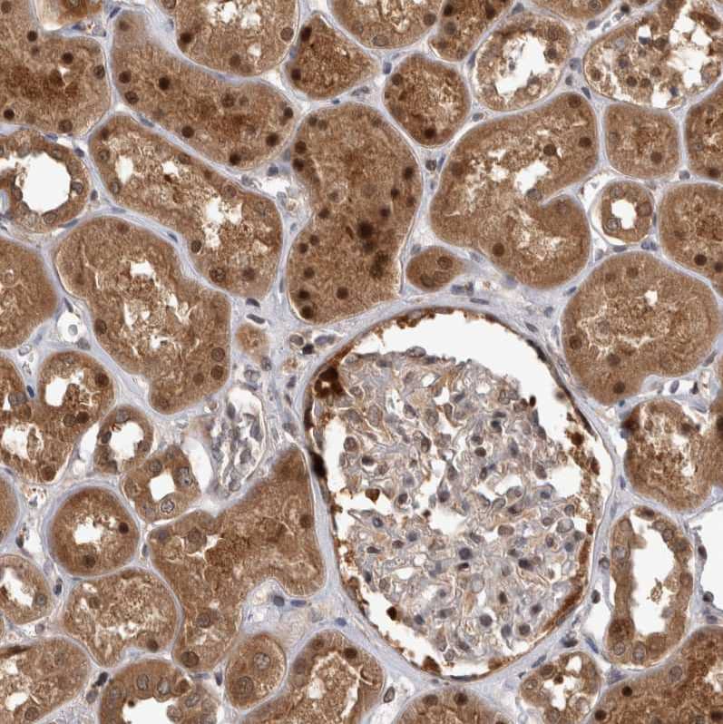 Staining of human kidney shows moderate to strong nuclear and cytoplasmic positivity in cells in tubules.