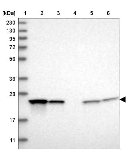 Lane 1: Marker [kDa] 230, 130, 95, 72, 56, 36, 28, 17, 11Lane 2: Human cell line RT-4Lane 3: Human cell line U-251MG spLane 4: Human plasma (IgG/HSA depleted)Lane 5: Human liver tissueLane 6: Human tonsil tissue