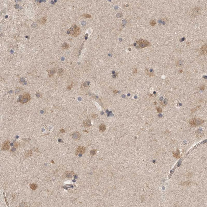 Staining of human cerebral cortex shows weak to moderate cytoplasmic positivity in neurons.