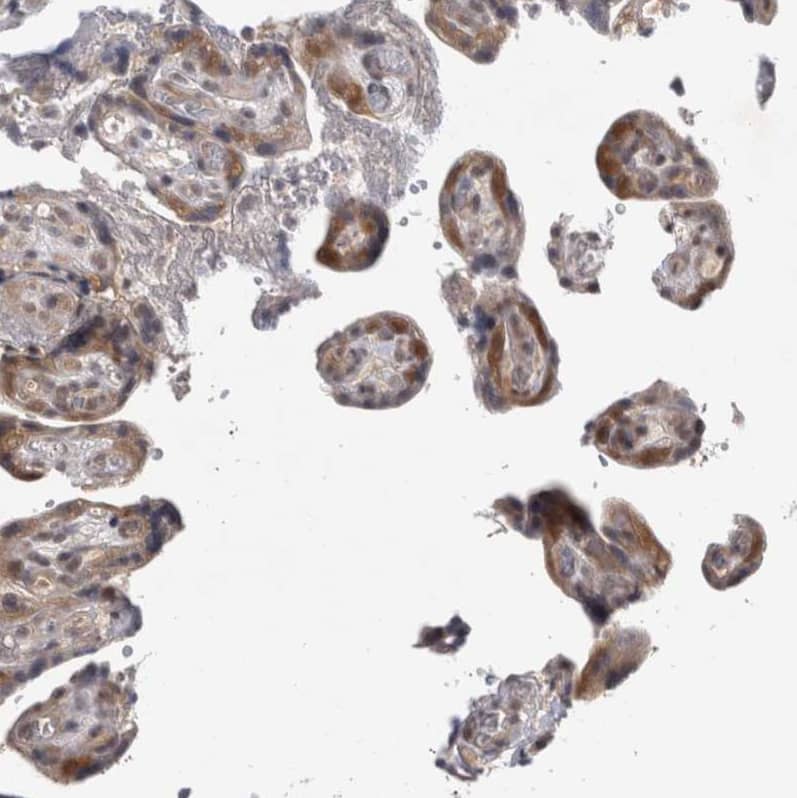 Staining of human placenta shows moderate to strong nuclear and cytoplasmic positivity in trophoblastic cells.