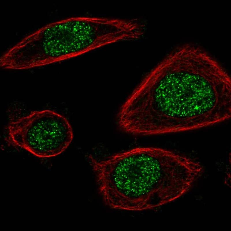 Staining of human cell line PC-3 shows localization to nucleoplasm.