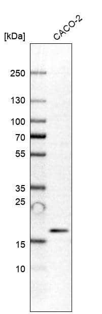 Analysis in human cell line CACO-2.