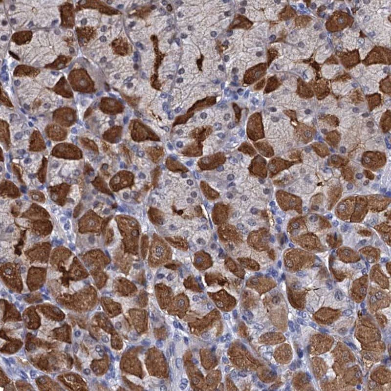 Staining of human stomach, upper shows strong cytoplasmic positivity in glandular cells.
