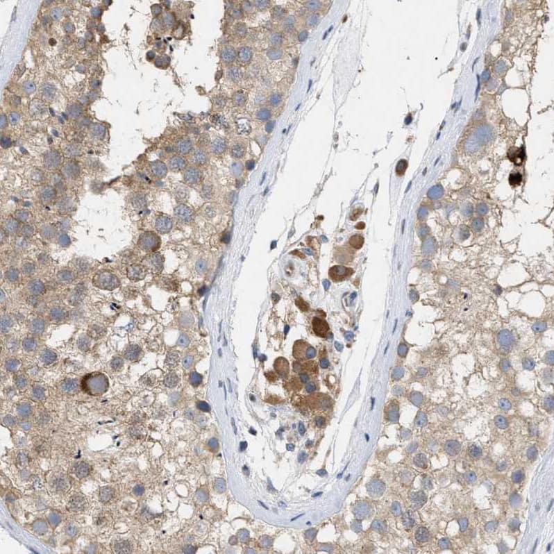 Staining of human testis shows moderate cytoplasmic membranous positivity in Leydig cells and weak cytoplasmic membranous positivity in cells in seminiferous cells.