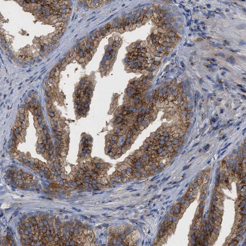 Staining of human prostate shows moderate cytoplasmic membranous positivity in glandular cells.