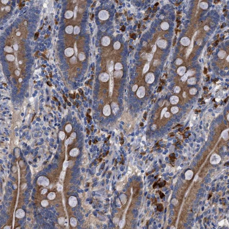 Staining of human duodenum shows moderate cytoplasmic membranous positivity in glandular cells and lymphoid cells.