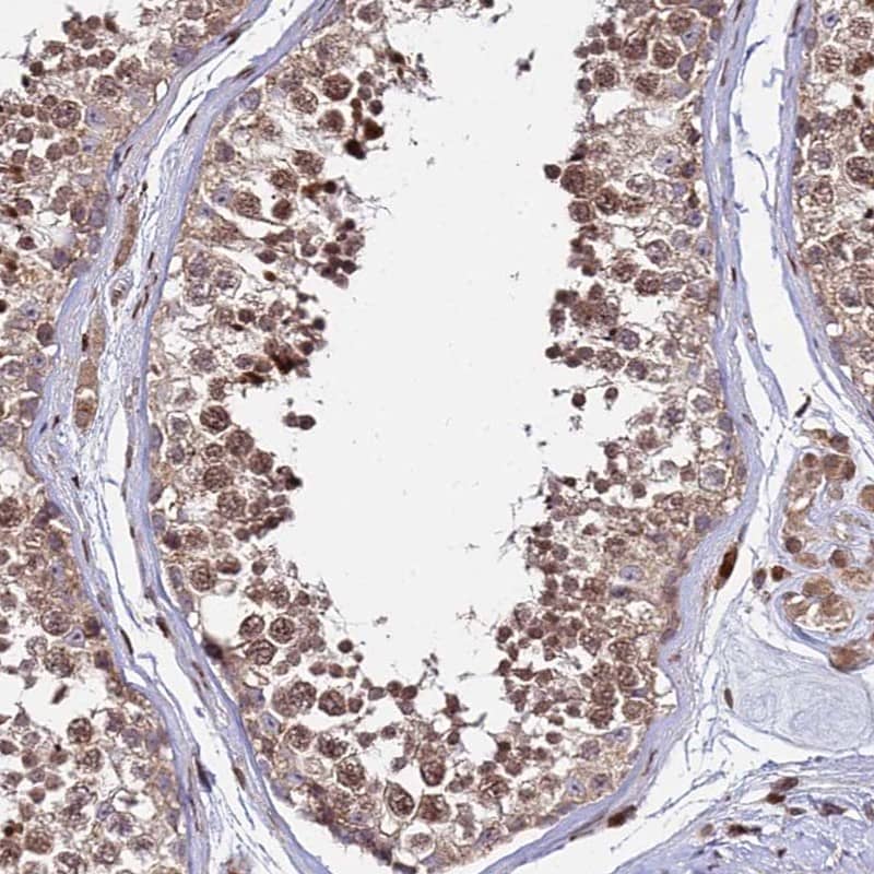 Staining of human testis shows moderate nuclear and cytoplasmic positivity in cells in seminiferous ducts.