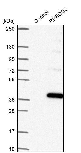 Western Blot RHBDD2 Antibody - BSA Free