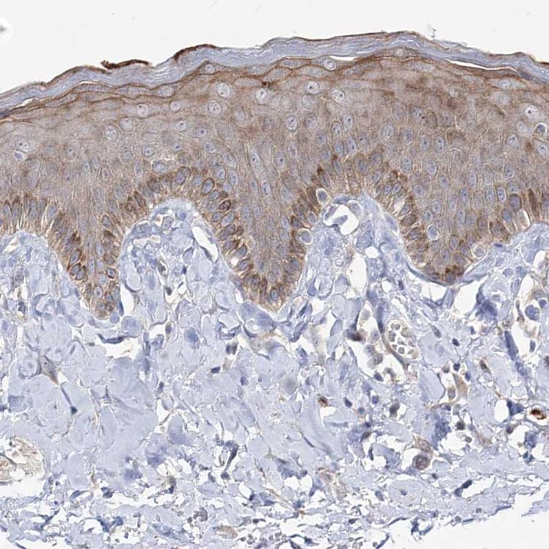 Immunohistochemistry-Paraffin RICS Antibody - BSA Free
