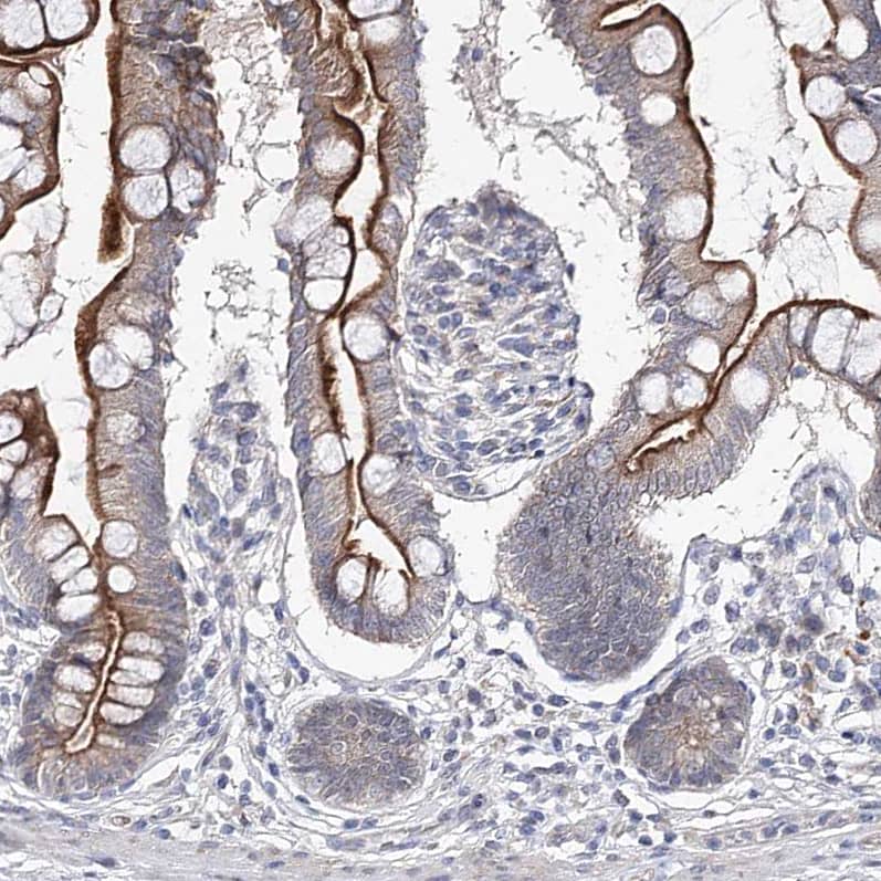 Immunohistochemistry-Paraffin RICS Antibody - BSA Free
