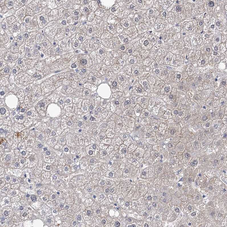 Staining of human liver shows no positivity in hepatocytes as expected.