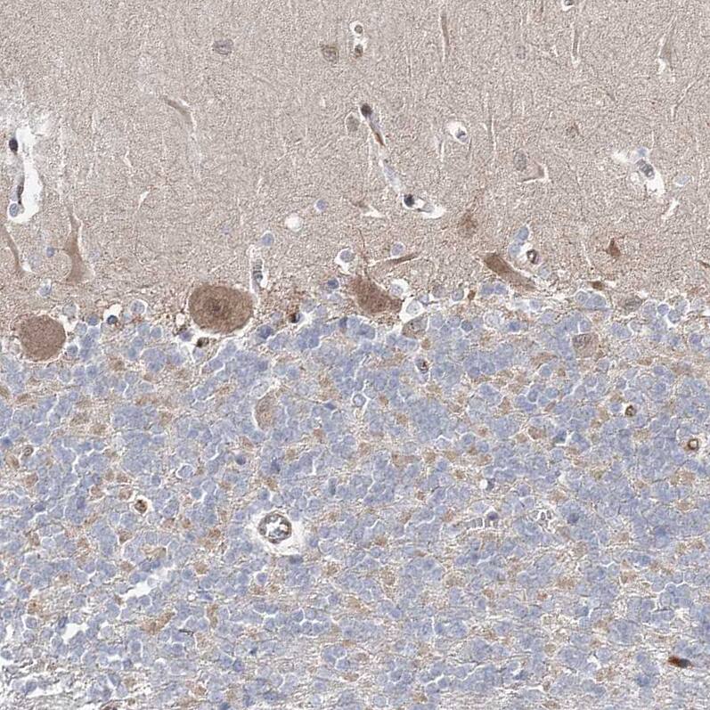 Staining of human cerebellum shows moderate positivity in Purkinje cells.