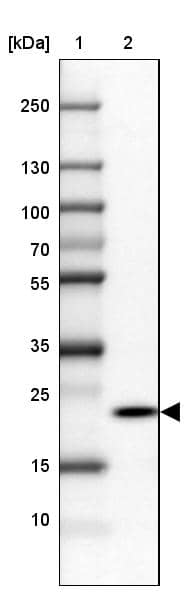 Lane 1: Marker [kDa] 250, 130, 100, 70, 55, 35, 25, 15, 10Lane 2: Human cell line SK-MEL-30