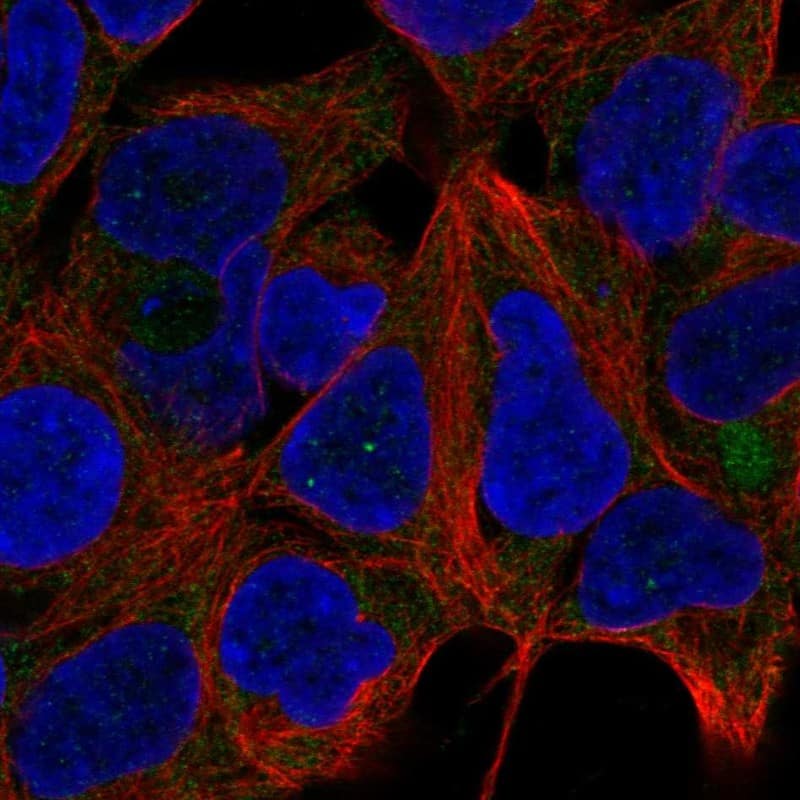 Staining of human cell line HEK 293 shows localization to endoplasmic reticulum.