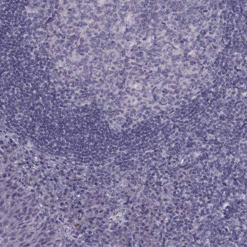 Staining of human tonsil shows no positivity in non-germinal center cells as expected.