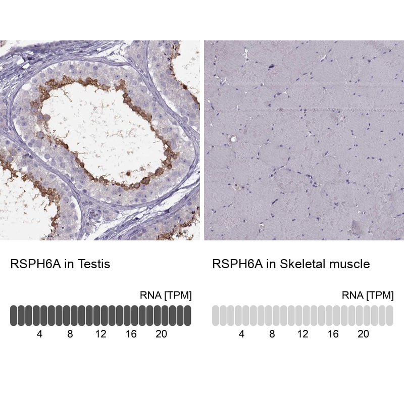 Analysis in human testis and skeletal muscle tissues using NBP1-92356 antibody. Corresponding RSPH6A RNA-seq data are presented for the same tissues.