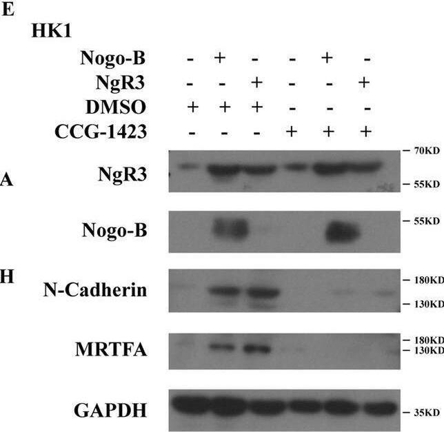Nogo-B promotes NPC cell migration by regulating RhoA-SRF-MRTFA.A The STRING database showed that Nogo-B and RhoA were associated. B Real-time PCR showed that RhoA, MRTFA, and SRF were highly expressed in TW03 (left) and HK1 (right) cell lines overexpressing Nogo-B and NgR3. C Western blotting showed that RhoA-GTP, MRTFA, and SRF were highly expressed in TW03 (left) and HK1 (right) cell lines overexpressing Nogo-B and NgR3. D Immunohistochemistry showed that overexpressing NgR3 and Nogo-B upregulated p-RhoA expression in metastatic mouse lung xenografts. E After treatment with CCG-1423(30 μmol/L) for 24 h, the expression of FAK and N-Cadherin decreased in HK1 cell lines. F The average number of migrated cells in three fields of HK1 cell lines with overexpressing Nogo-B or NgR3 decreased after using CCG-1423(30 μmol/L). G The average number of invaded cells in three fields of HK1 cell lines with overexpressing Nogo-B or NgR3 decreased after using CCG-1423(30 μmol/L). Image collected and cropped by CiteAb from the following open publication (//pubmed.ncbi.nlm.nih.gov/35075114), licensed under a CC-BY license. Not internally tested by Novus Biologicals.