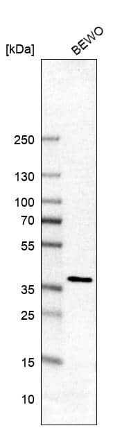 Analysis in human cell line BEWO.