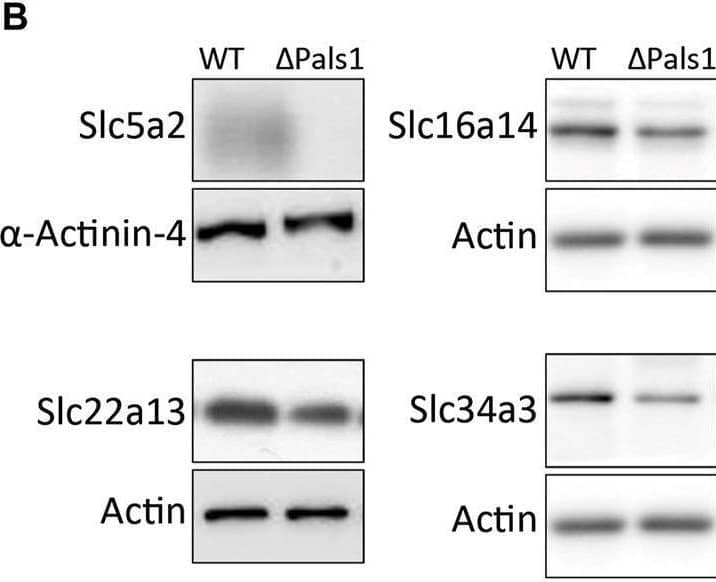 Pals1-dependent expression of abundant members of the solute carrier family members in renal nephrons. (A) Quantitative real-time RT PCR analysis of mRNA levels derived from Pals1-deficient kidneys (∆Pals1) and their wildtype (WT) littermate controls. In Pals1-deficient kidneys, six SLC genes summarized in Table 1 show a reduced mRNA expression in Pals1-deficient kidneys. (B) Western blotting confirmed downregulation on protein level for Slc5a2, Slc16a14, Slc22a13 and Slc43a3.  alpha -Actinin-4 and Actin served as loading controls. (C) Immunohistologic analysis from kidney sections derived from WT and Pals1-deficient mice. The glucose transporter Slc5a2 (magenta) co-localizes with the Lotus tetragonolobus Lectin coupled to fluorescein (LTL, green). The lectin LTL is a marker for proximal tubules in mammalian kidneys. DAPI (blue) labels the nuclei of cells. Although downregulated, Slc5a2 glucose transporters localize at the brush border membrane of proximal tubules in Pals1-deficient mice. Bar = 10 μm. Image collected and cropped by CiteAb from the following open publication (//pubmed.ncbi.nlm.nih.gov/35252349), licensed under a CC-BY license. Not internally tested by Novus Biologicals.