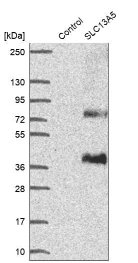 Western Blot SLC13A5 Antibody - BSA Free