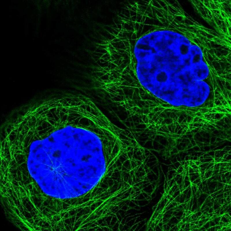 Immunocytochemistry/ Immunofluorescence SLC24A1 Antibody - BSA Free